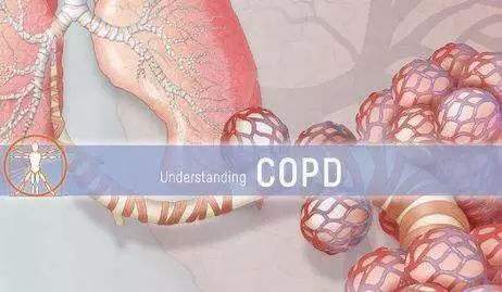 Why do COPD patients need to expectorate? - COXTOD